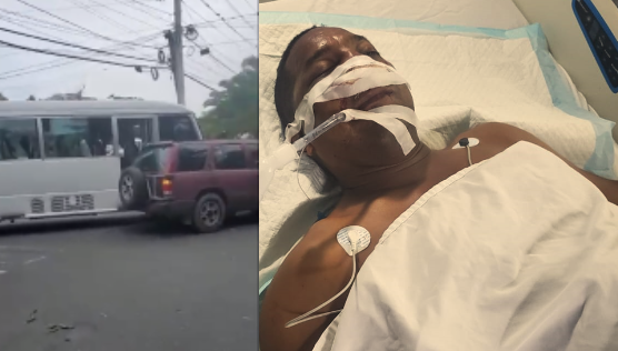 Conductor de yipeta atropellado por chofer de guagua se encuentra en estado delicado