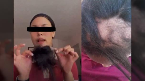 Imponen arresto domiciliario con permiso para asistir a la escuela, a adolescente que arrancó el cabello a otra